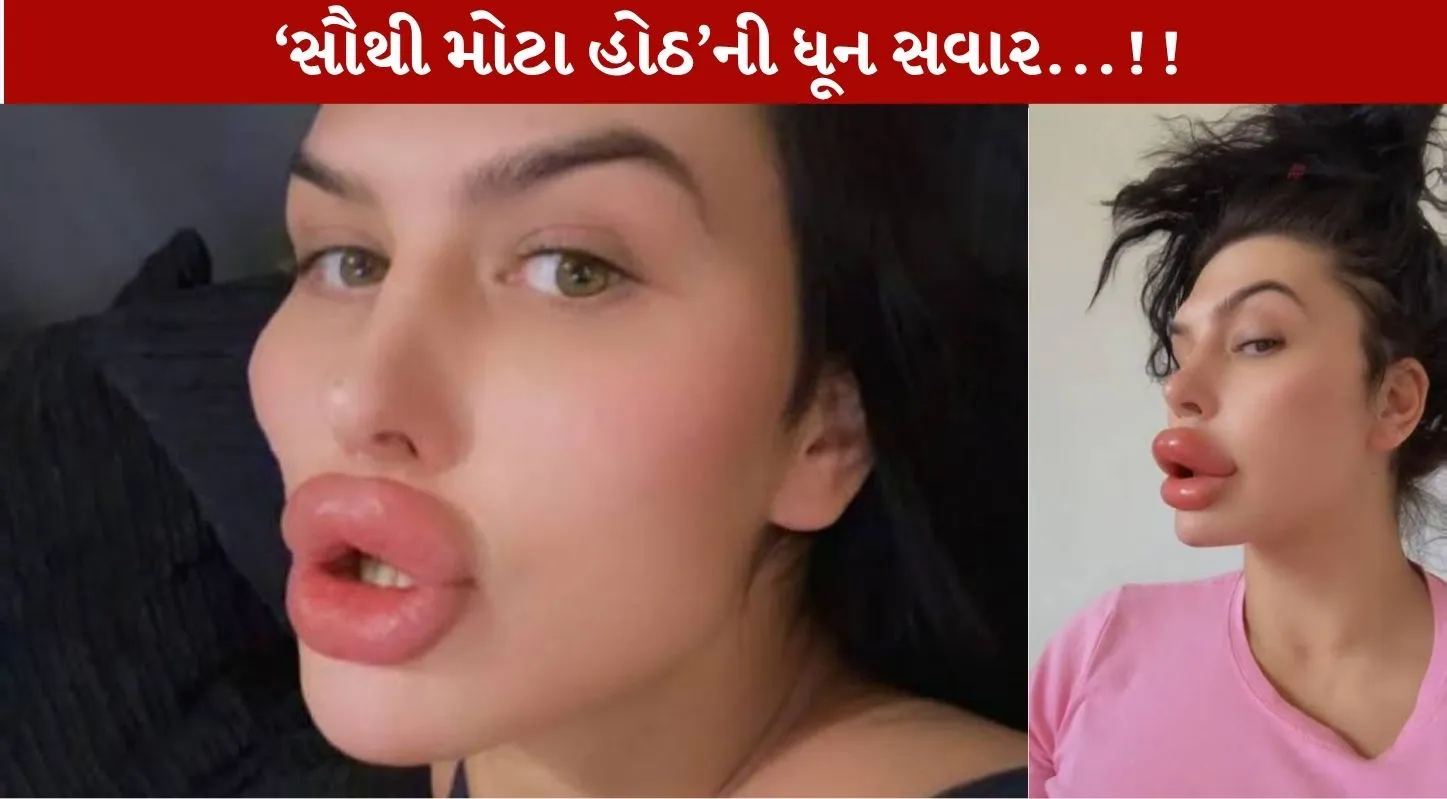 Sophia Lips સુર્ખીઓમાં...બ્રિટીશ મોડેલે જાતે જ 2 હોઠોની સર્જરી કરી! Shocking ઘટના વાયરલ....