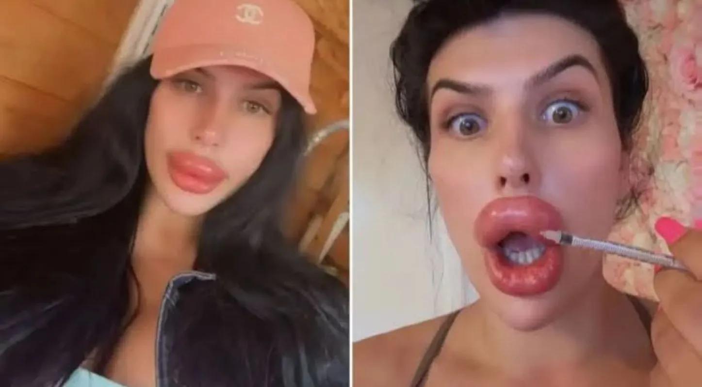 Sophia injects Botox herself