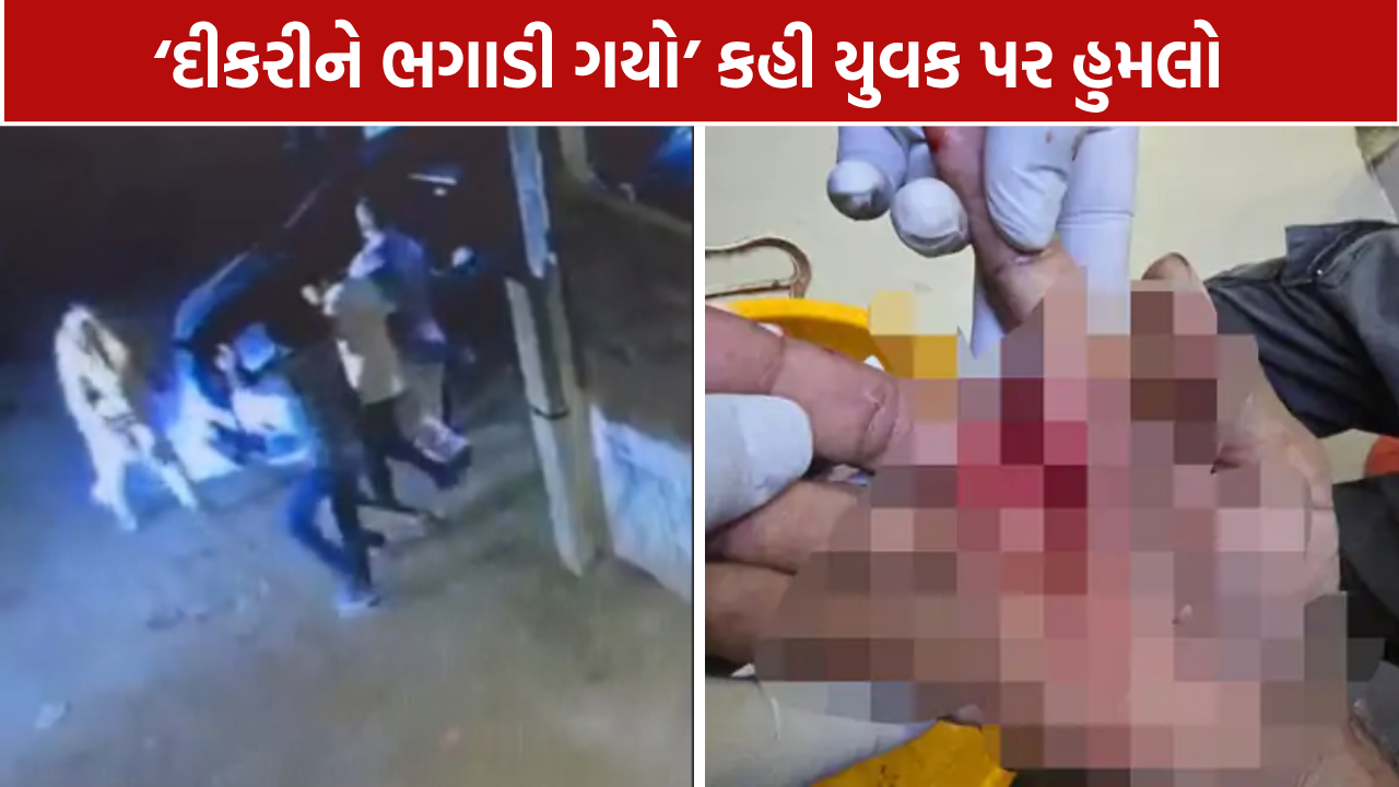 Vanpardi Youth Attack: 4 શખ્સોએ હાથ પર ધારદાર હથિયારથી કર્યો વાર